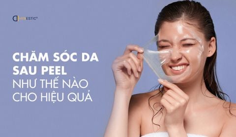 CHĂM SÓC DA SAU PEEL NHƯ THẾ NÀO CHO HIỆU QUẢ