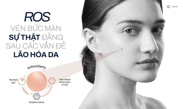 ROS - VÉN BỨC MÀN SỰ THẬT ĐẰNG SAU CÁC VẤN ĐỀ LÃO HÓA DA