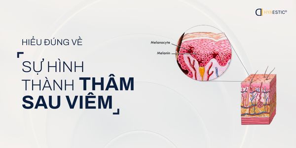 HIỂU ĐÚNG VỀ SỰ HÌNH THÀNH THÂM SAU VIÊM