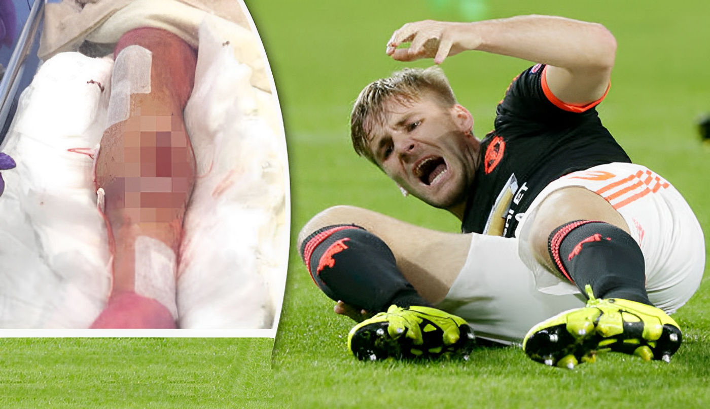 Luke Shaw gặp chấn thương nặng nề năm 2015