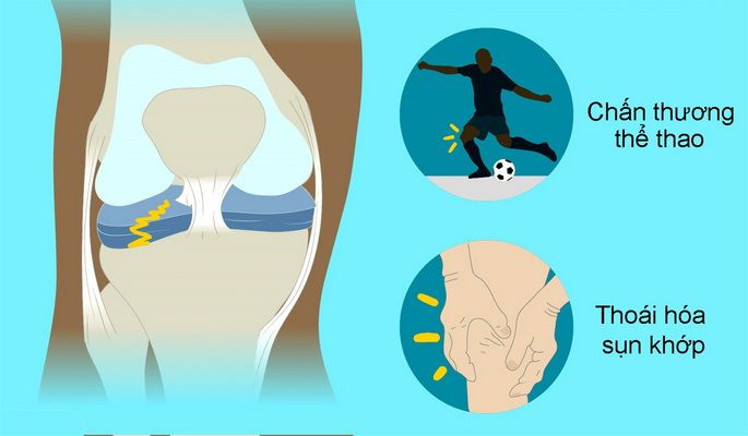 chấn thương đầu gối