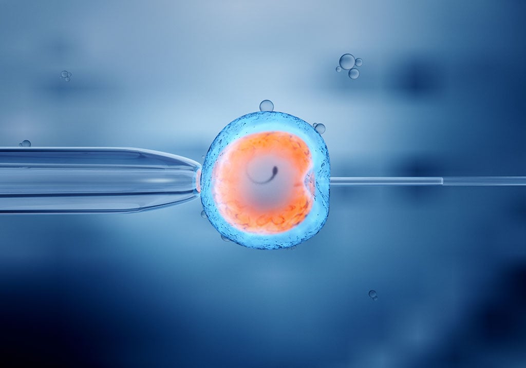 GIẢI ĐÁP CÁC PHƯƠNG PHÁP THỤ TINH ỐNG NGHIỆM IVF
