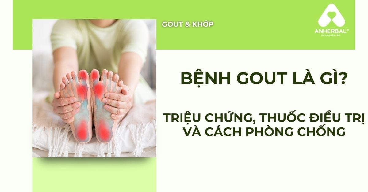 Bệnh Gout Là Gì? Triệu Chứng Và Cách Phòng Chống Hiệu Quả