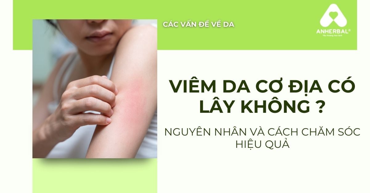 Viêm da cơ địa có lây không? Nguyên nhân và cách chăm sóc hiệu quả