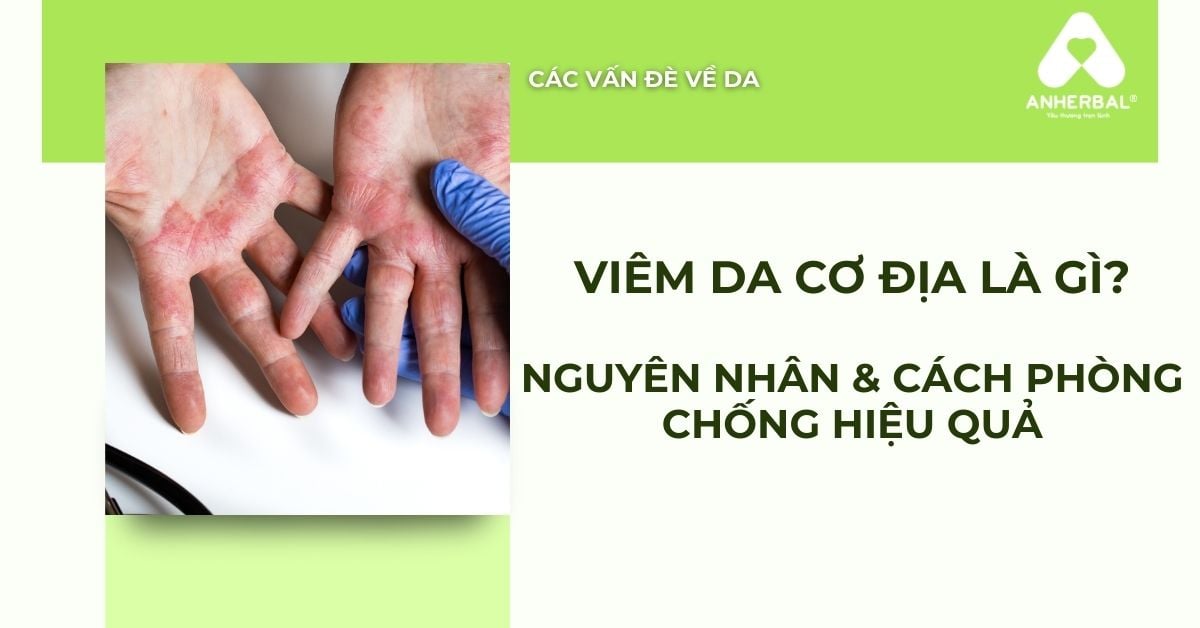 Viêm da cơ địa là gì? Nguyên nhân & cách phòng chống hiệu quả
