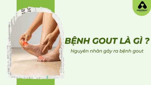 bệnh gout là gì? nguyên nhân gây ra gout