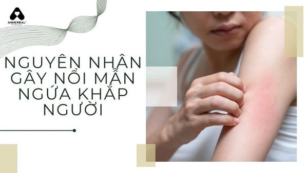 nguyên nhân gây nổi mẫn ngứa khắp người