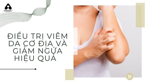 điều trị viêm da cơ địa và giảm ngứa hiệu quả