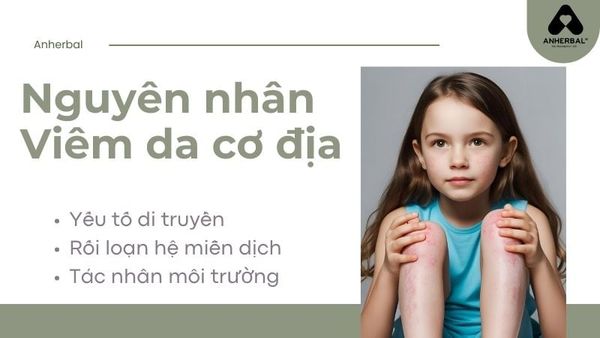 Nguyên Nhân Viêm Da Cơ Địa Dị Ứng