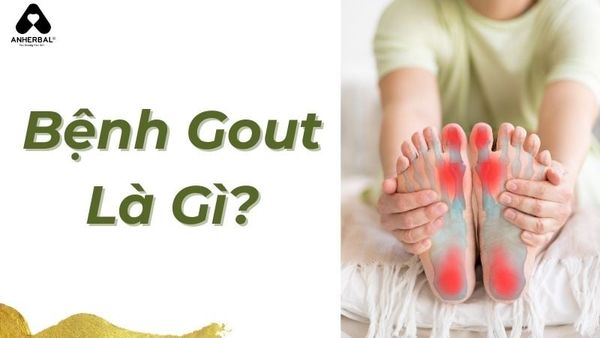bệnh gout là gì?