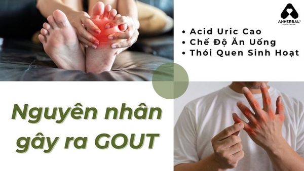 nguyên nhân gây ra GOUT