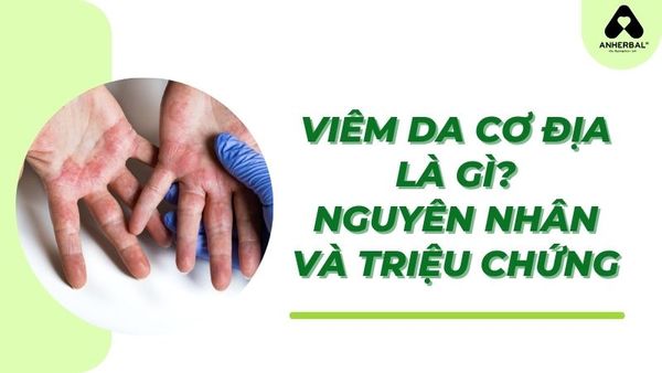 viêm da cơ địa là gì? nguyên nhân và triệu chứng