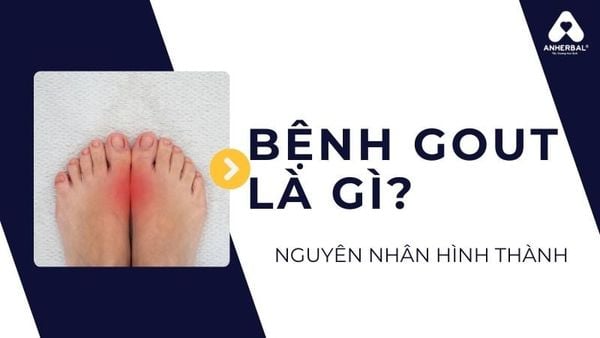 bệnh gout là gì?
