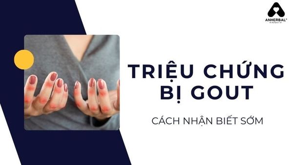 triệu chứng bị gout