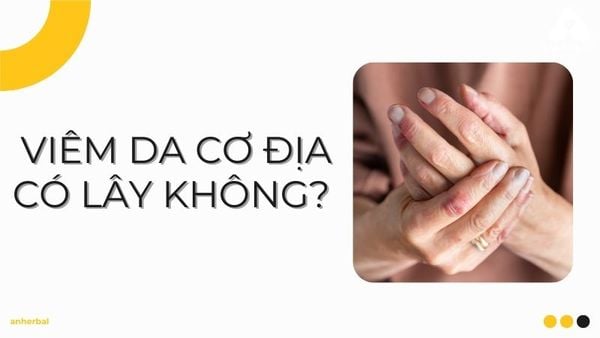 viêm da cơ địa có lây không