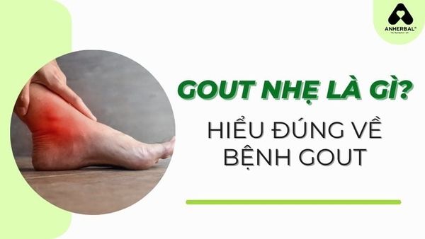 gout nhẹ là gì ? hiếu đúng về bệnh gout