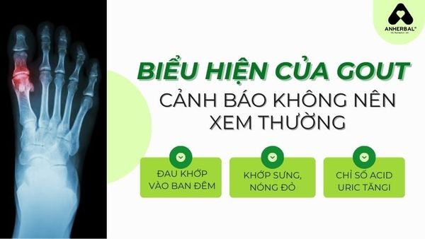 biểu hiện của bệnh gout