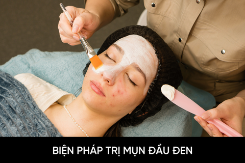 Biện pháp trị mụn đầu đen