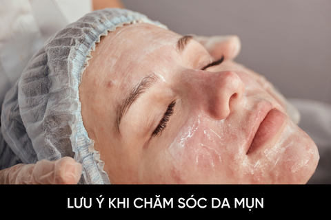 Lưu ý khi chăm sóc da mụn