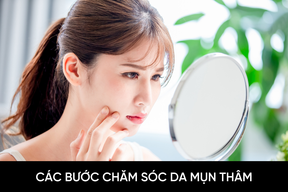 Các bước chăm sóc da mụn thâm