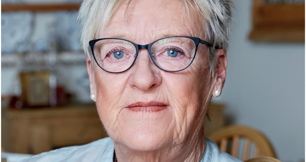 Cuối cùng đốm sắc tố trên mặt của tôi cũng biến mất