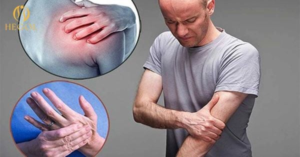 Hội chứng cổ vai cánh tay - Cách nhận biết và phương pháp ...