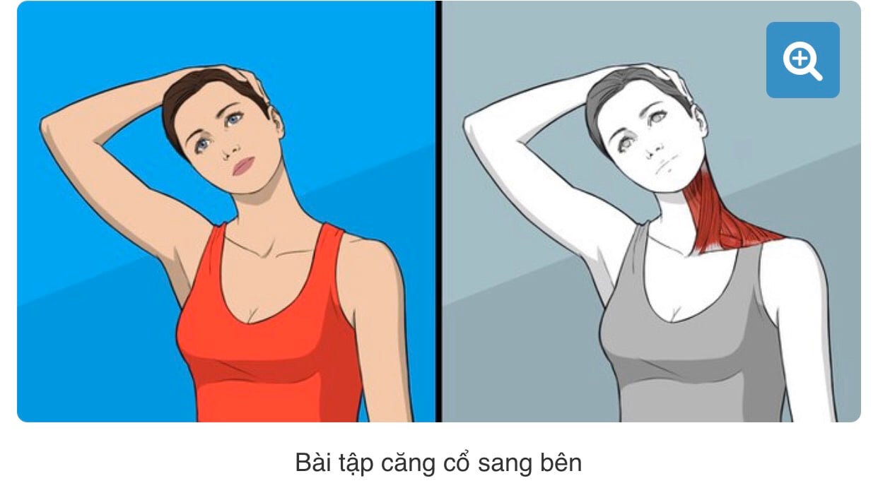 Căng duỗi phần cơ hai bên cổ chữa đau vai gáy