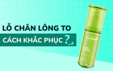 Lỗ chân lông to: Cách khắc phục