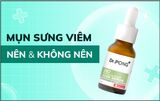 Mụn Sưng Viêm: Nên và Không Nên