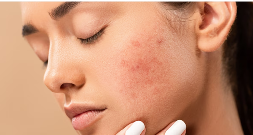 5 DẤU HIỆU TỔN THƯƠNG DỄ NHẬN BIẾT TRÊN DA