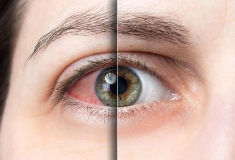 Nguyên nhân, hậu quả của các bệnh về mắt và cách khắc phục
