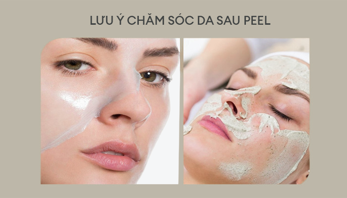 5 LƯU Ý CHĂM SÓC DA SAU PEEL BẠN CẦN GHI NHỚ– Tegoder Cosmetics Việt Nam