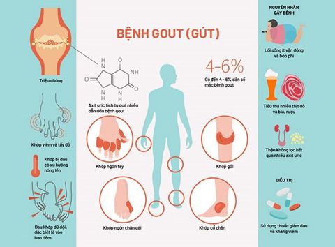 Cách nhận biết và điều trị bệnh Gout tại nhà đơn giản, hiệu quả