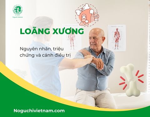 Loãng xương: Nguyên nhân, triệu chứng và cách điều trị