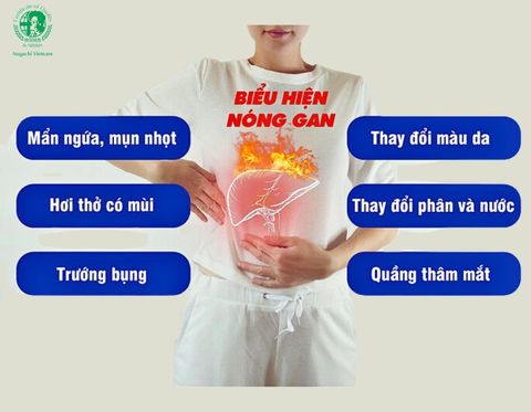 Bệnh nóng gan có dấu hiệu như thế nào ? Cách điều trị như sao ?