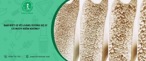 Bạn biết gì về loãng xương độ 3? Có nguy hiểm không?