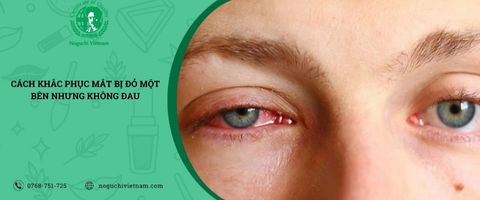 Cách khắc phục mắt bị đỏ một bên nhưng không đau