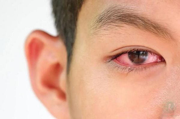 Hình ảnh sản phẩm