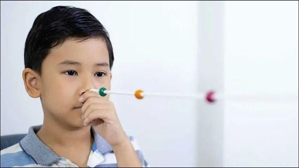 Bài tập Chuỗi Brock – Cải thiện khả năng phối hợp giữa hai mắt