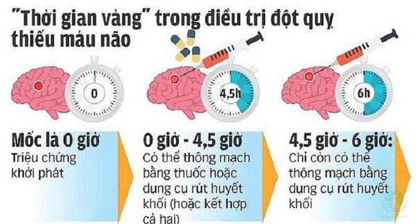 thời gian vàng trong cấp cứu đột quỵ