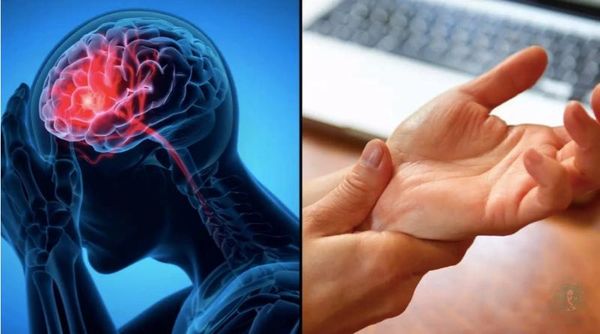 dấu hiệu đột quỵ trước 1 ngày không nên bỏ qua