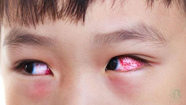 Hình ảnh sản phẩm
