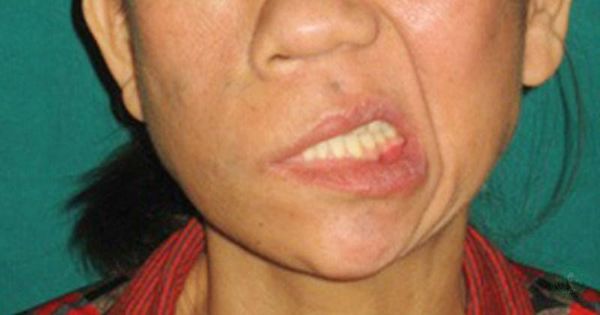 Hình ảnh sản phẩm