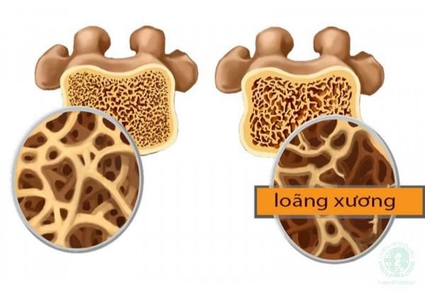 Hình ảnh sản phẩm