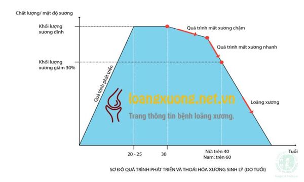 Độ tuổi bị loãng xương bao nhiêu