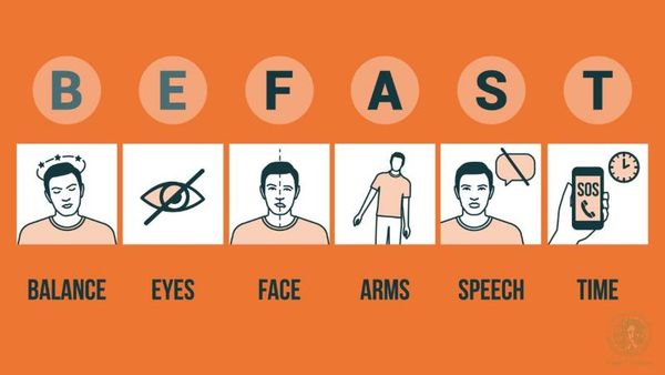 quy tắc BE FAST trong đột quỵ