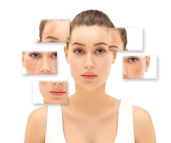 NÁM DA VÀ CÁCH TRỊ NÁM, MỜ THÂM, SÁNG DA HIỆU QUẢ TẠI NHÀ