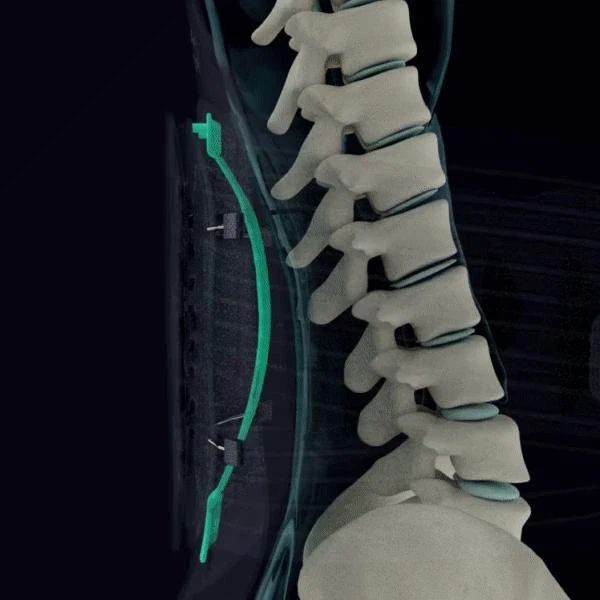 Đai kéo giãn cột sống Alphay YGAH-6 Hỗ trợ cột sống thắt lưng có thể điều chỉnh