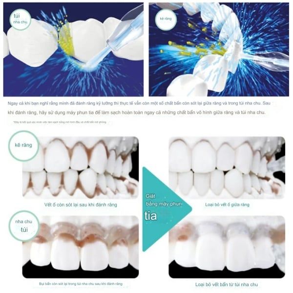 Máy tăm nước Panasonic DJ54 - Giải pháp chăm sóc răng miệng hoàn hảo