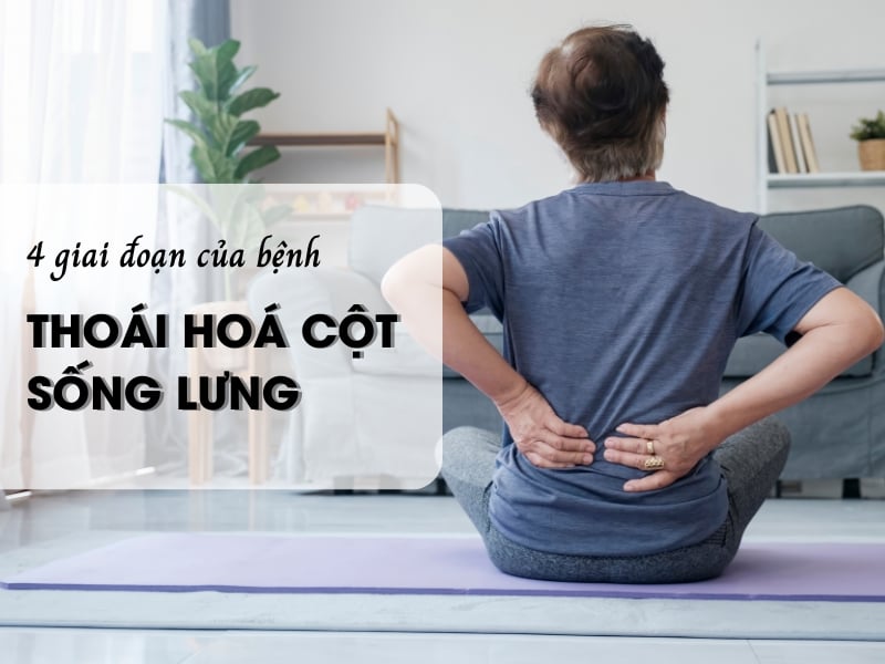 4 giai đoạn thoái hóa cột sống lưng
